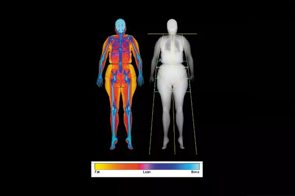 Advanced Body Composition & Weight Management