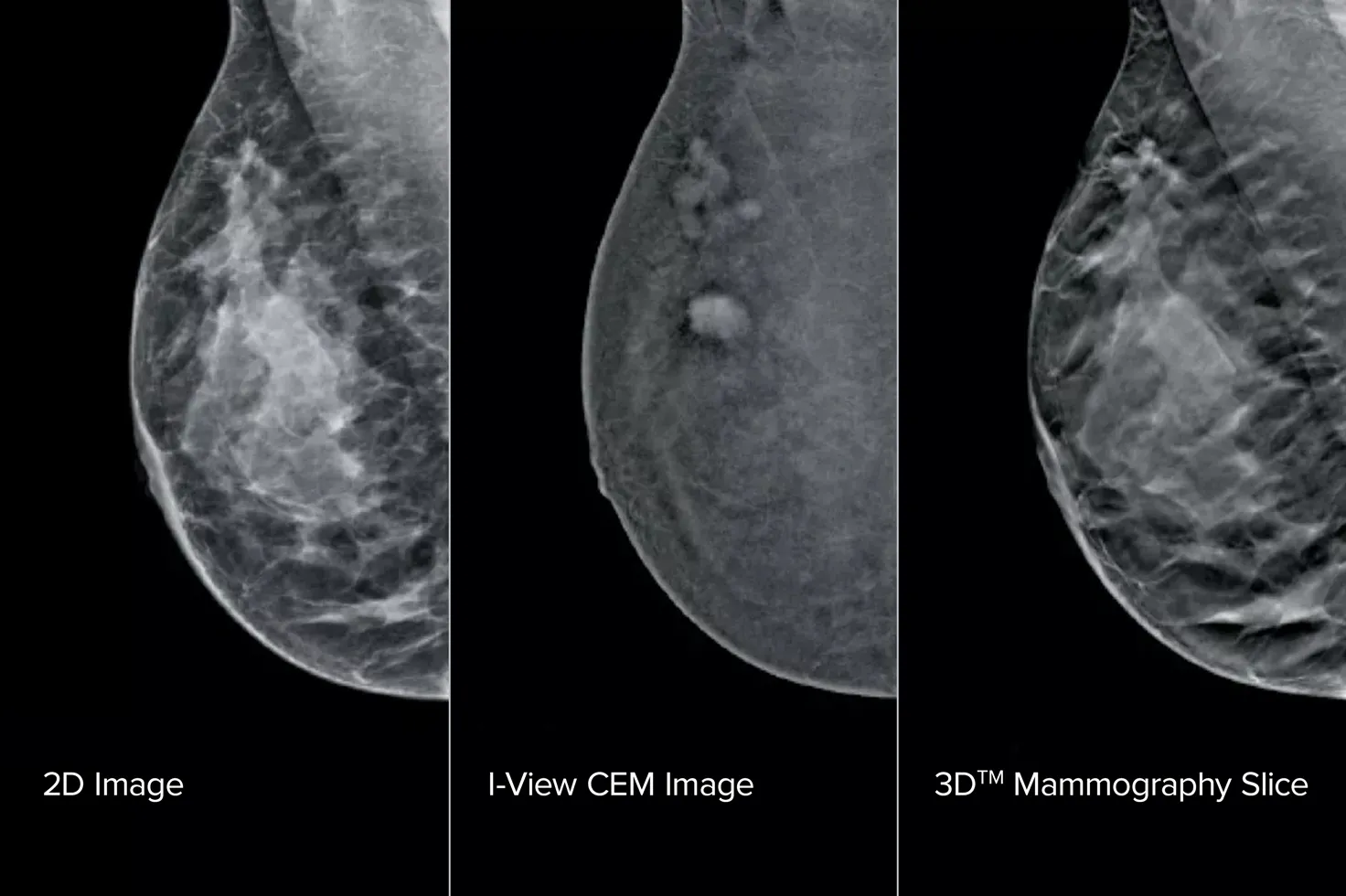 Breast scans images in 2D, I-View CEM and 3D Mammography Slice