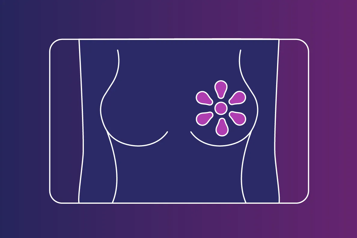 Linework illustration representing breast imaging